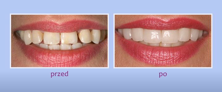 Galeria uśmiechów - zdjęcie 10