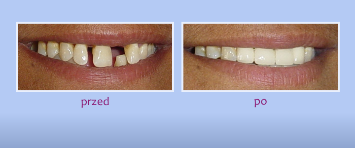 Galeria uśmiechów - zdjęcie 4