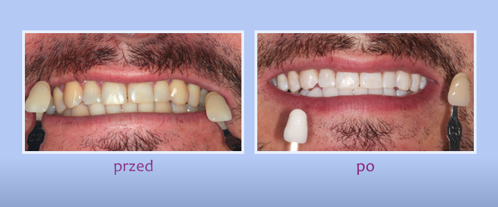 Galeria uśmiechów - zdjęcie 5