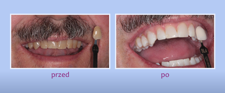 Galeria uśmiechów - zdjęcie 6