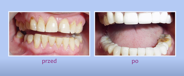 Galeria uśmiechów - zdjęcie 7