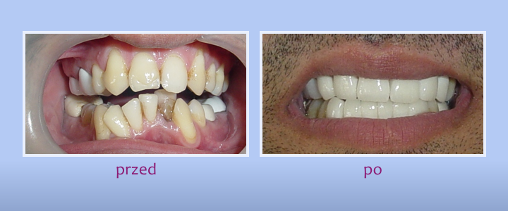 Galeria uśmiechów - zdjęcie 8