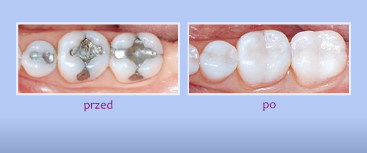 Galeria uśmiechów - zdjęcie 9